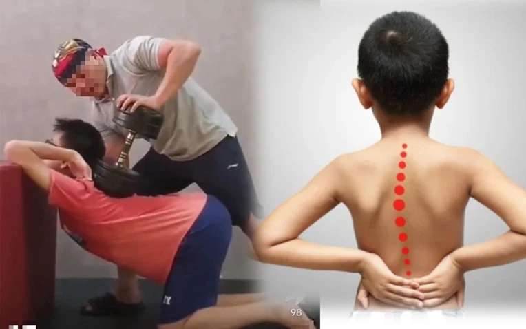 The trend of cure humpback helps to increase the height of the child by pressing the weight on the back, pressing the bone when swinging, experts also look scared!
