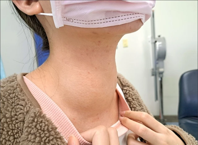 4 foods are good, but eating too many thyroids unbearable, sooner or later, they are sick