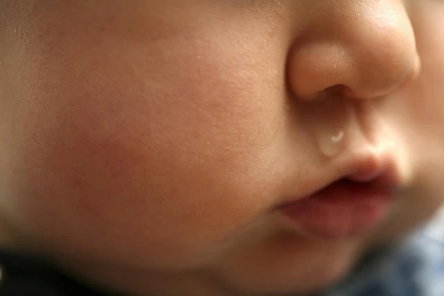 The doctor shows how to prevent dangerous complications of sinusitis in children