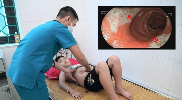 Phu Tho: The 9 -year -old boy has 2 duodenal ulcer, the main reason from the habits of many parents