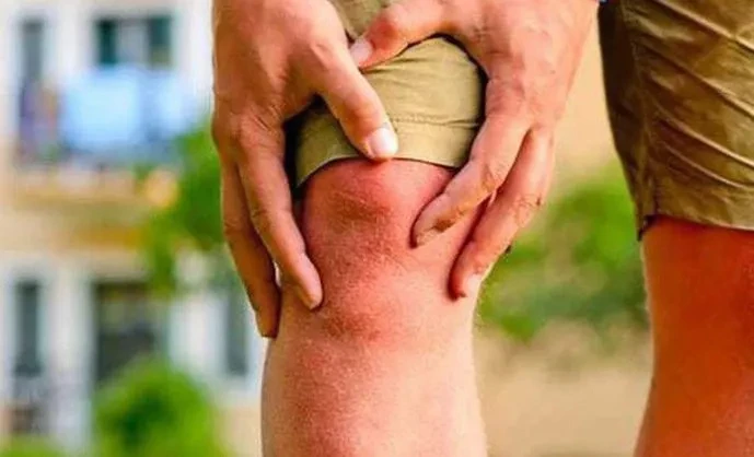 Treating arthritis but still likes to use a drink, the man with edematous face, severe pain