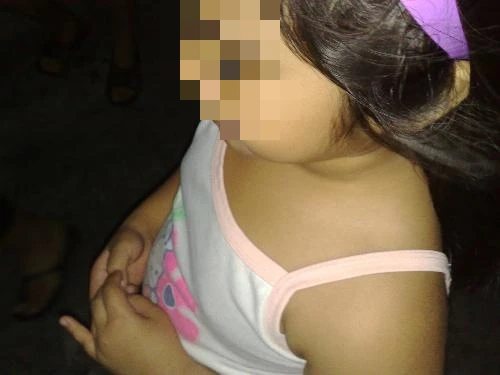 The 6 -year -old girl had early puberty, the reason because she loves to feed 2 dishes that are both complementary and delicious