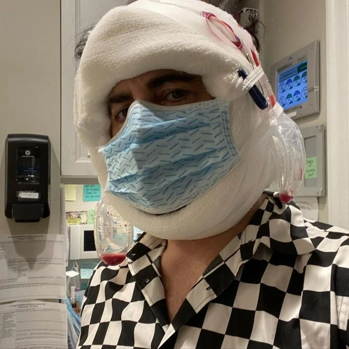 Marc Jacobs spent $ 50,000 to raise facial muscles