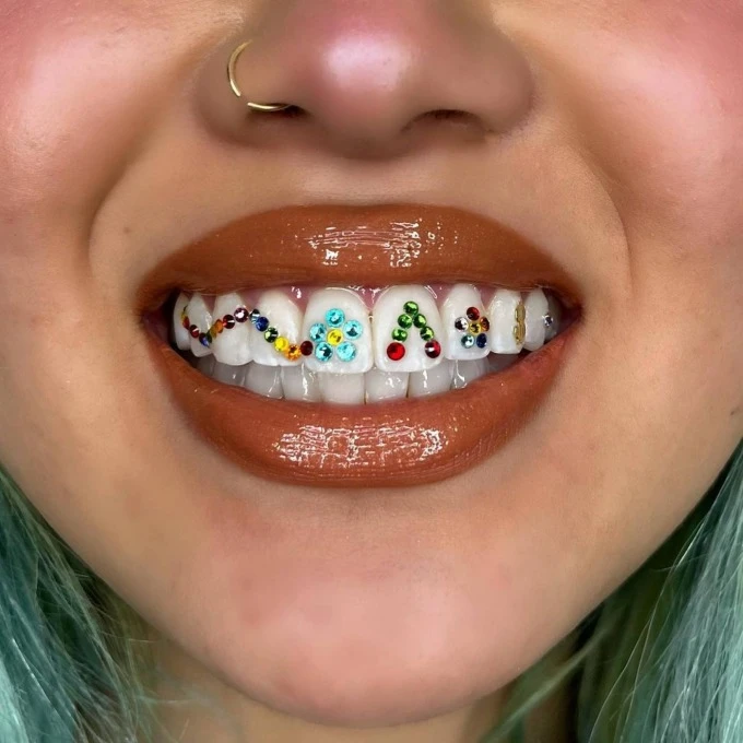 Crystal fad on teeth