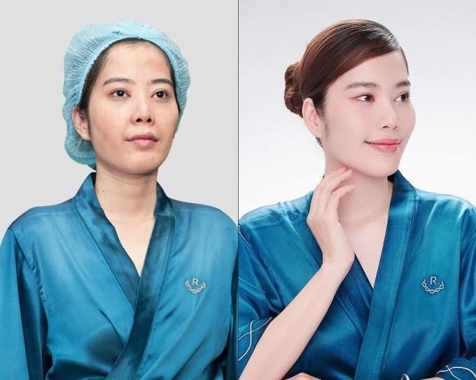 Nam Em experienced beauty treatment at Ruco International Clinic