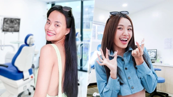 Tu Tri and Cat Ngoc shared how to own a confident smile