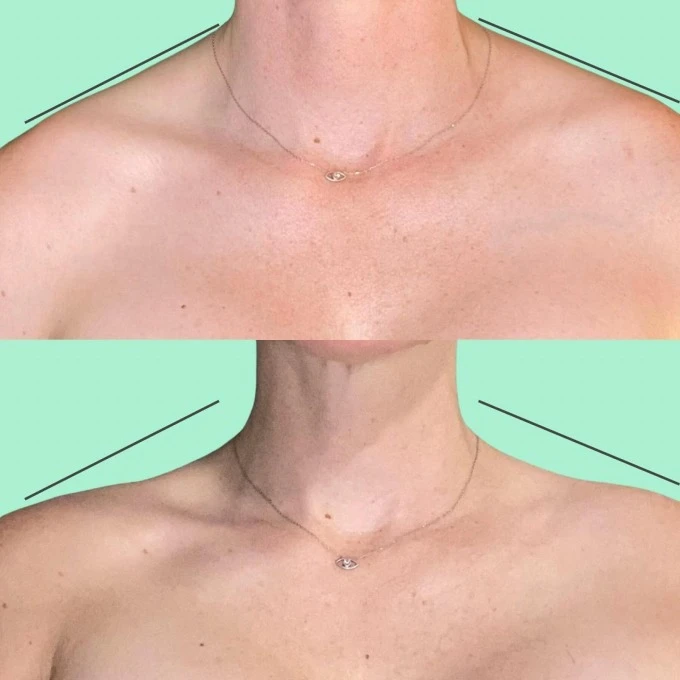 Fashion beauty effect