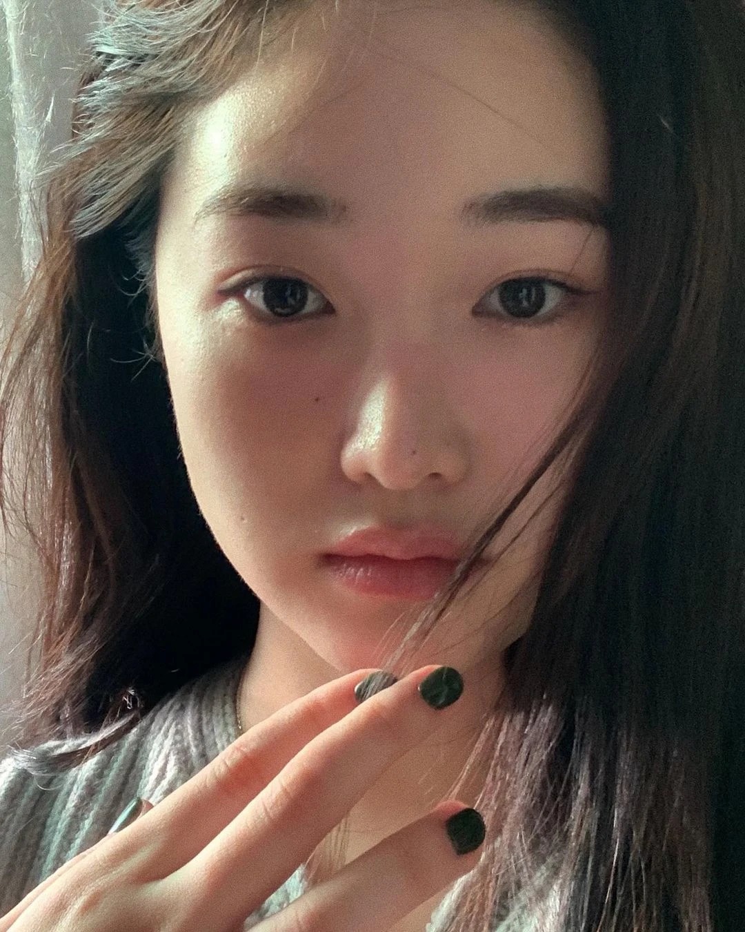 Revealing extremely strong 5 tips to prevent dark spots for the girls who are passionate ... squeezing acne, there are tips just need to do in 30 seconds!