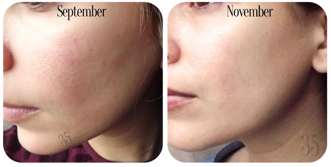 Using vitamin C regularly skin is still dark, the main answer in the "wrong" preservation step that many women still think is right