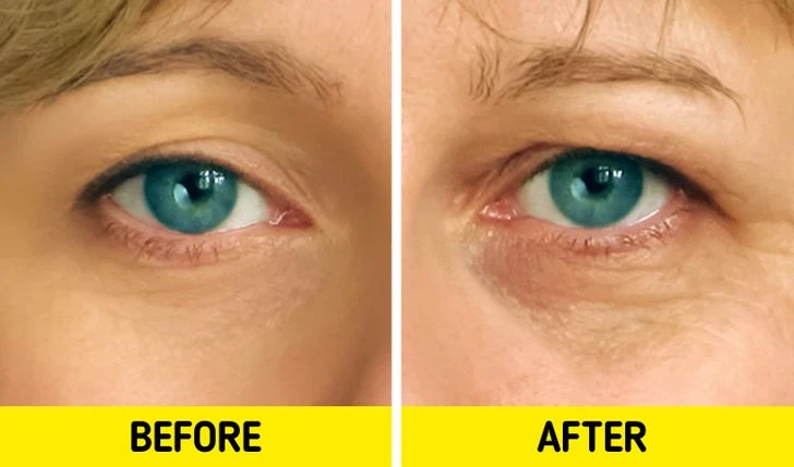 6 common skin care views but bad mistakes