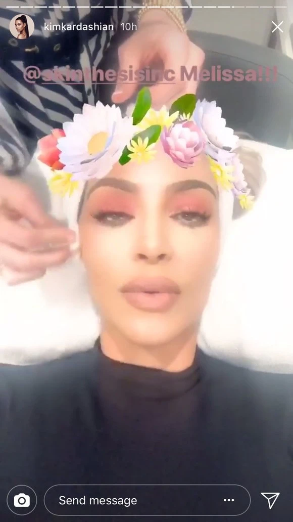 Laser therapy but Kim Kardashian still keeps the makeup and this is a doctor's advice