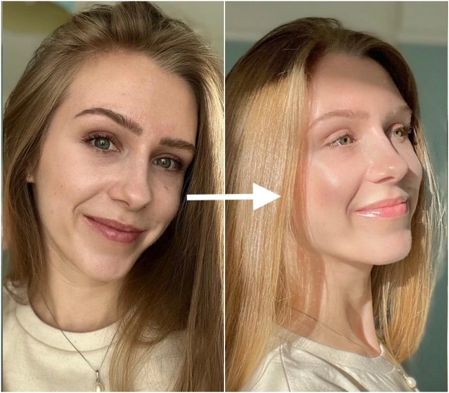 Anti -aging age 30+: The key step of the doctor advises to do 365 days/ year