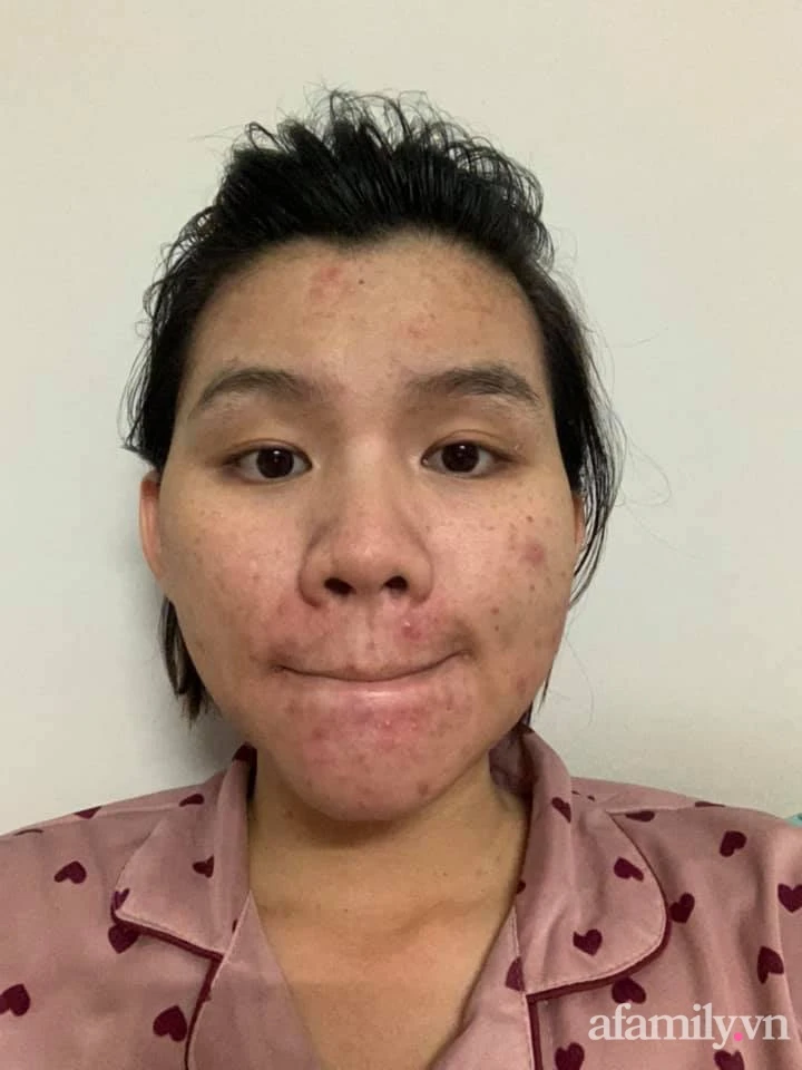After giving birth, the skin was scattered, so ugly that she was so inferior to her husband, 9X's mother decided to improve the "interface" that made netizens only say one word: "Peak"