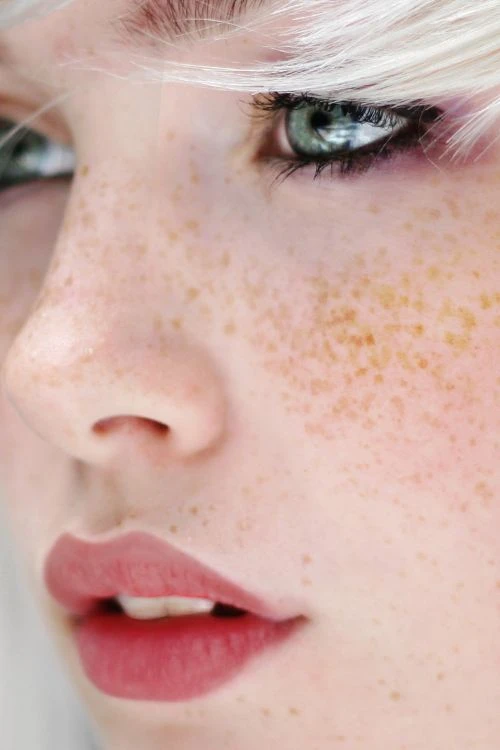 5 Tips makeup helps you "live together" with melasma, freckles