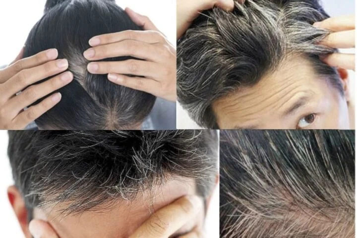 How to limit gray hair early?
