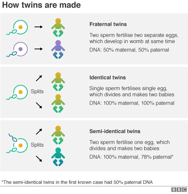 The story behind the magic of creation on twins and the pitiful status of the world's most rare twin style