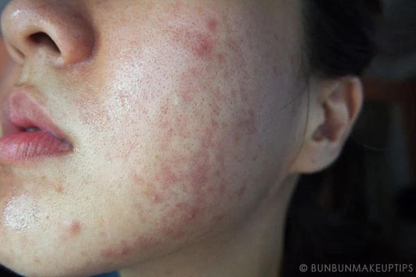 Apply a mask with oriental medicine: Do not take the face as an experiment